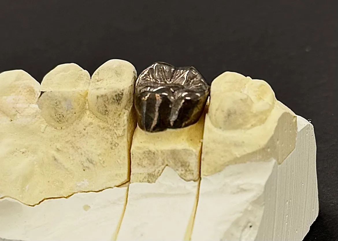 金銀パラジウム合金