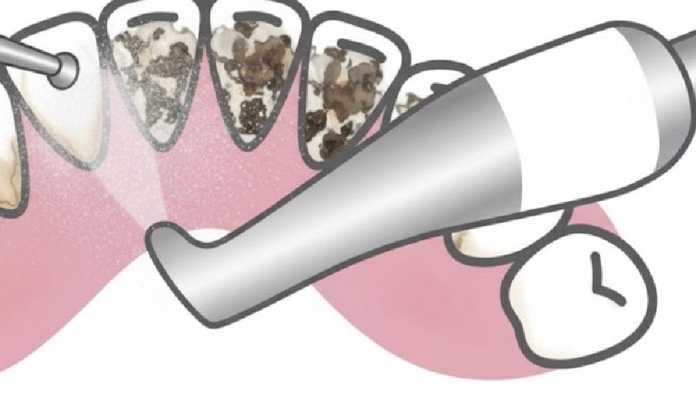 どんな場面で使われるの？
